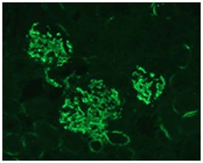 Immunocytochemistry/ Immunofluorescence - Anti-C3 antibody [11H9] (AB11862), expandable thumbnail