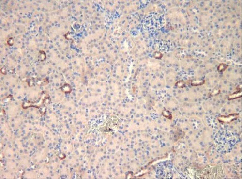 Immunohistochemistry (Formalin/PFA-fixed paraffin-embedded sections) - Anti-C3 antibody (AB11887)