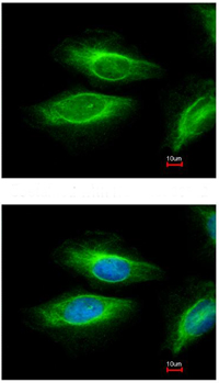 Immunocytochemistry/ Immunofluorescence - Anti-C3 antibody (ab97462), expandable thumbnail