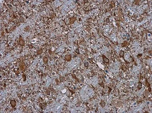 Immunohistochemistry (Formalin/PFA-fixed paraffin-embedded sections) - Anti-C3 antibody (AB97462)