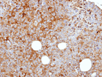Immunohistochemistry (Formalin/PFA-fixed paraffin-embedded sections) - Anti-C3 antibody (ab97462), expandable thumbnail