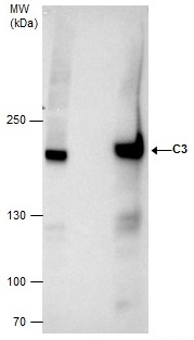Immunoprecipitation - Anti-C3 antibody (AB97462), expandable thumbnail