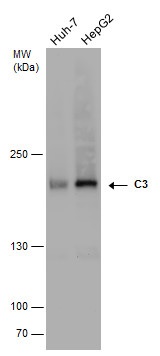 Western blot - Anti-C3 antibody (AB97462), expandable thumbnail