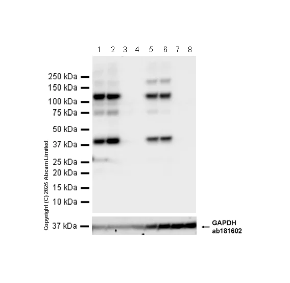 Western blot - Anti-C3 antibody [EPR19394] (AB200999)