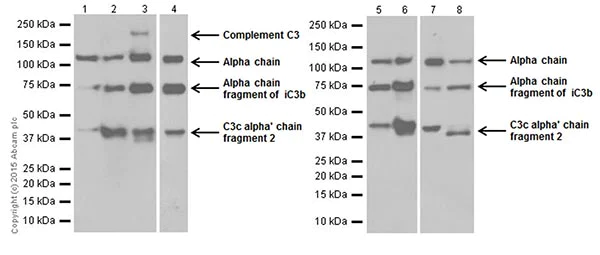 Western blot - Anti-C3 antibody [EPR19394] (AB200999)