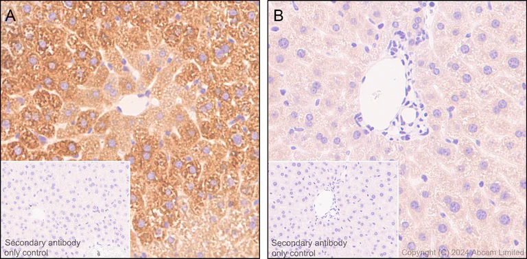 Immunohistochemistry (Formalin/PFA-fixed paraffin-embedded sections) - Anti-C3 antibody [EPR19394] - BSA and Azide free (AB271967)