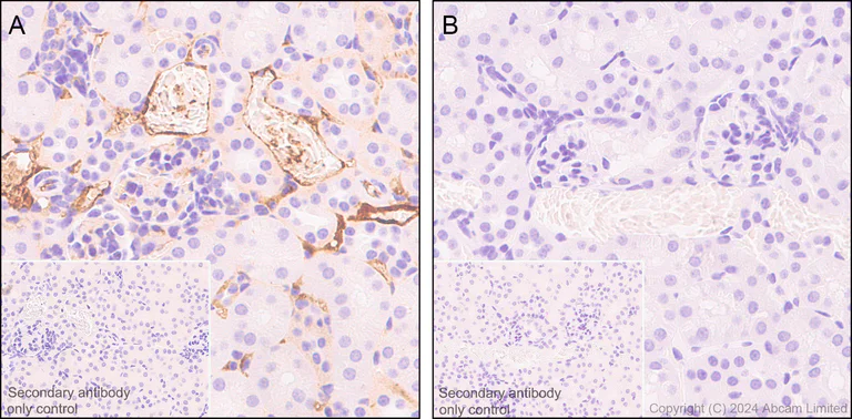 Immunohistochemistry (Formalin/PFA-fixed paraffin-embedded sections) - Anti-C3 antibody [EPR19394] - BSA and Azide free (AB271967)