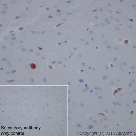 Immunohistochemistry (Formalin/PFA-fixed paraffin-embedded sections) - Anti-C3 antibody [EPR19394] - Low endotoxin, Azide free (AB225539)
