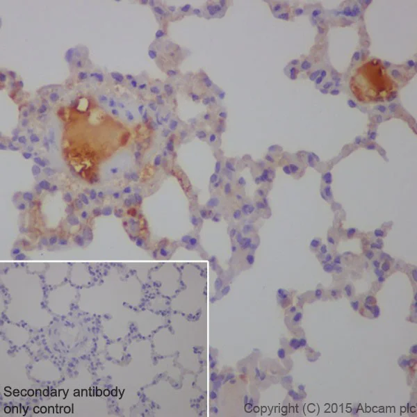 Immunohistochemistry (Formalin/PFA-fixed paraffin-embedded sections) - Anti-C3 antibody [EPR19394] - Low endotoxin, Azide free (AB225539)