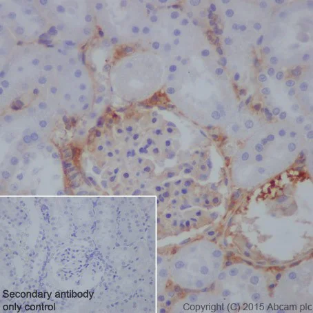 Immunohistochemistry (Formalin/PFA-fixed paraffin-embedded sections) - Anti-C3 antibody [EPR19394] - Low endotoxin, Azide free (AB225539)