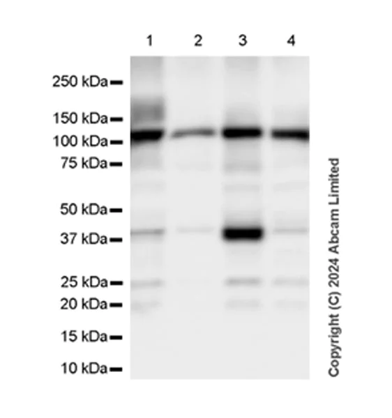 Western blot - Anti-C3 antibody [EPR26515-77] (AB321966)
