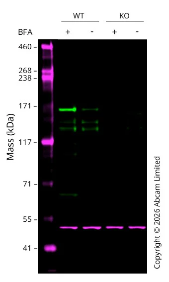 Western blot - Anti-C3 antibody [EPR26515-77] (AB321966)