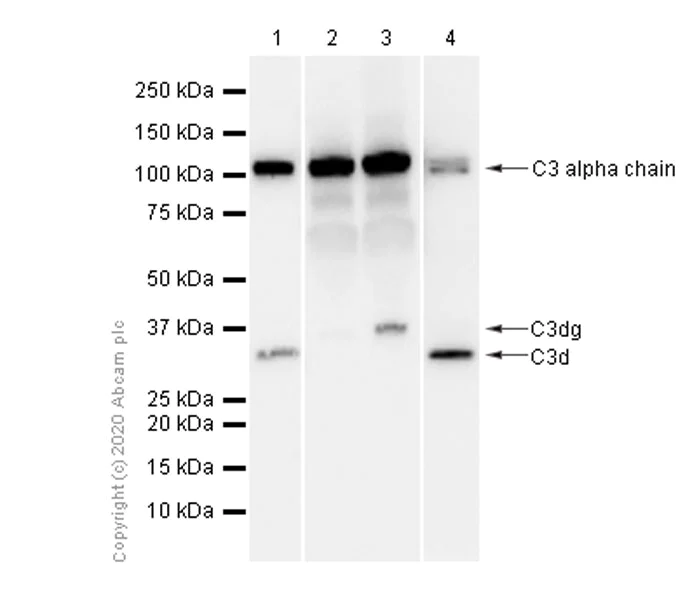 Western blot - Anti-C3 antibody [EPR2988] (AB181147)