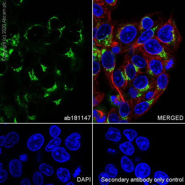 Immunocytochemistry/ Immunofluorescence - Anti-C3 antibody [EPR2988] - BSA and Azide free (AB240245)