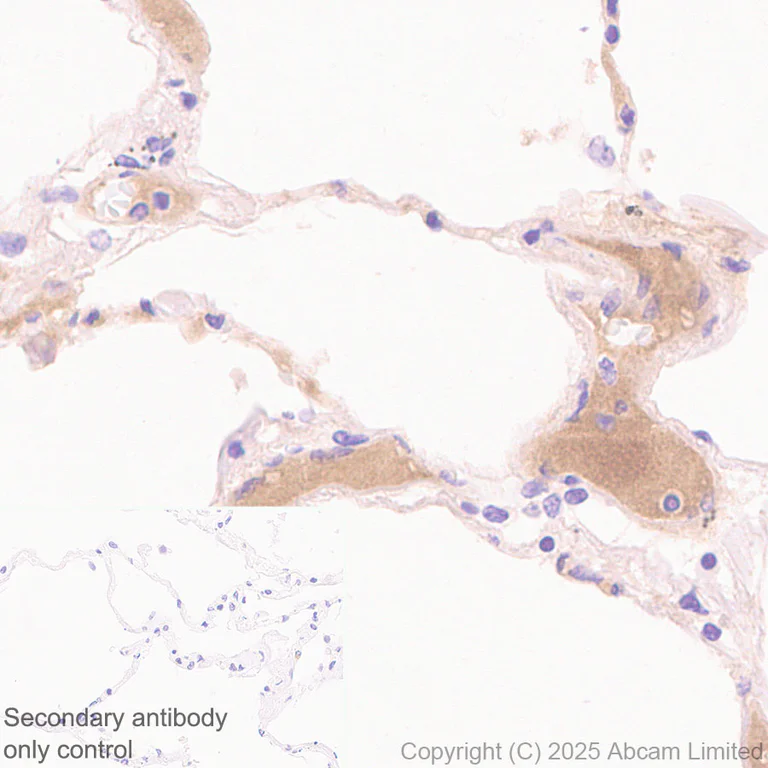Immunohistochemistry (Formalin/PFA-fixed paraffin-embedded sections) - Anti-C3 antibody [RM1270] (AB324288)