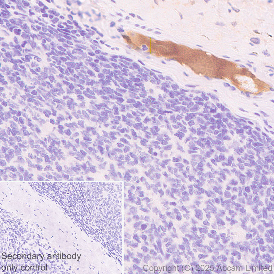 Immunohistochemistry (Formalin/PFA-fixed paraffin-embedded sections) - Anti-C3 antibody [RM1270] (ab324288), expandable thumbnail