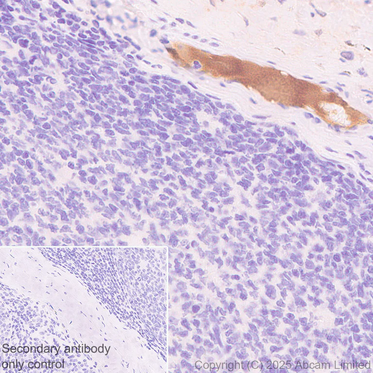 Immunohistochemistry (Formalin/PFA-fixed paraffin-embedded sections) - Anti-C3 antibody [RM1270] (AB324288)