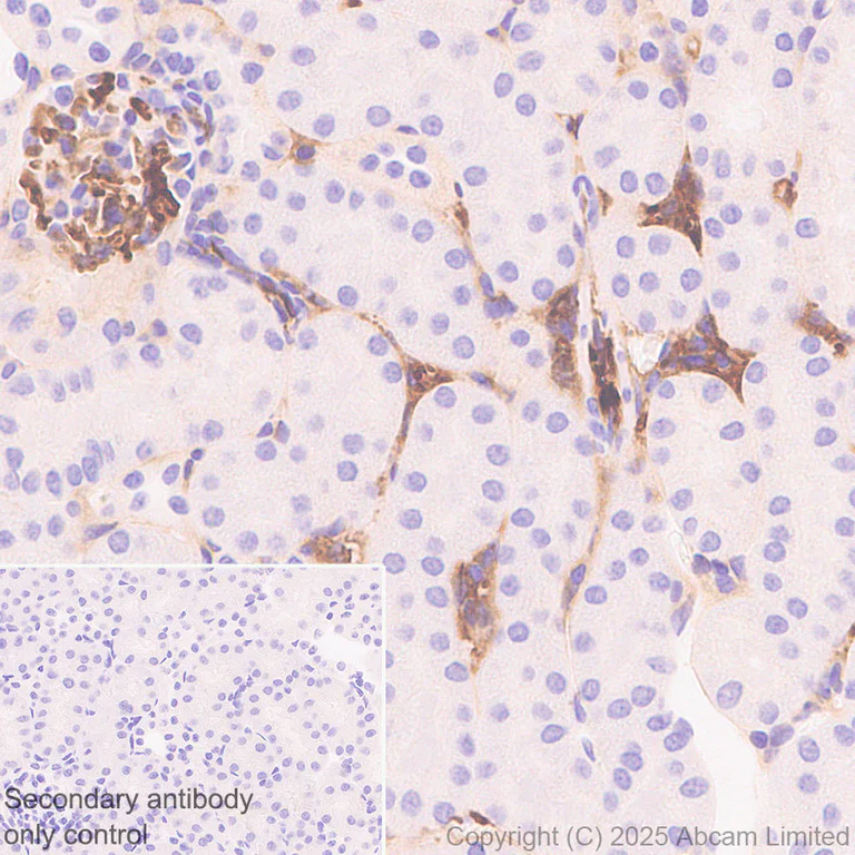 Immunohistochemistry (Formalin/PFA-fixed paraffin-embedded sections) - Anti-C3 antibody [RM1270] (AB324288)
