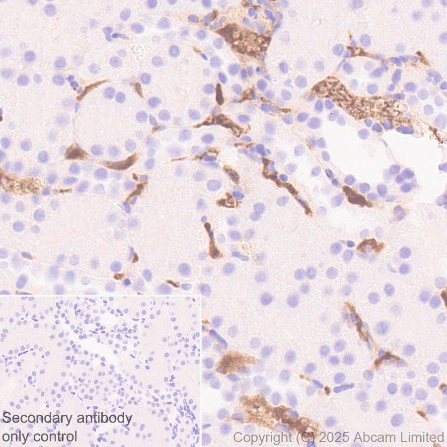 Immunohistochemistry (Formalin/PFA-fixed paraffin-embedded sections) - Anti-C3 antibody [RM1270] (ab324288), expandable thumbnail