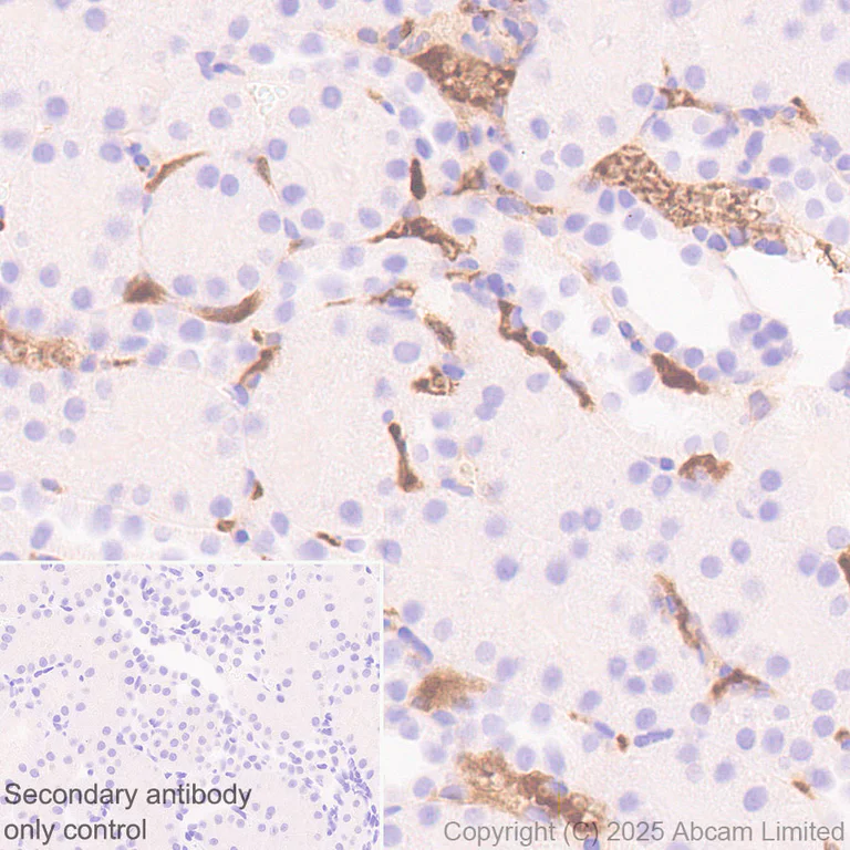 Immunohistochemistry (Formalin/PFA-fixed paraffin-embedded sections) - Anti-C3 antibody [RM1270] (AB324288)