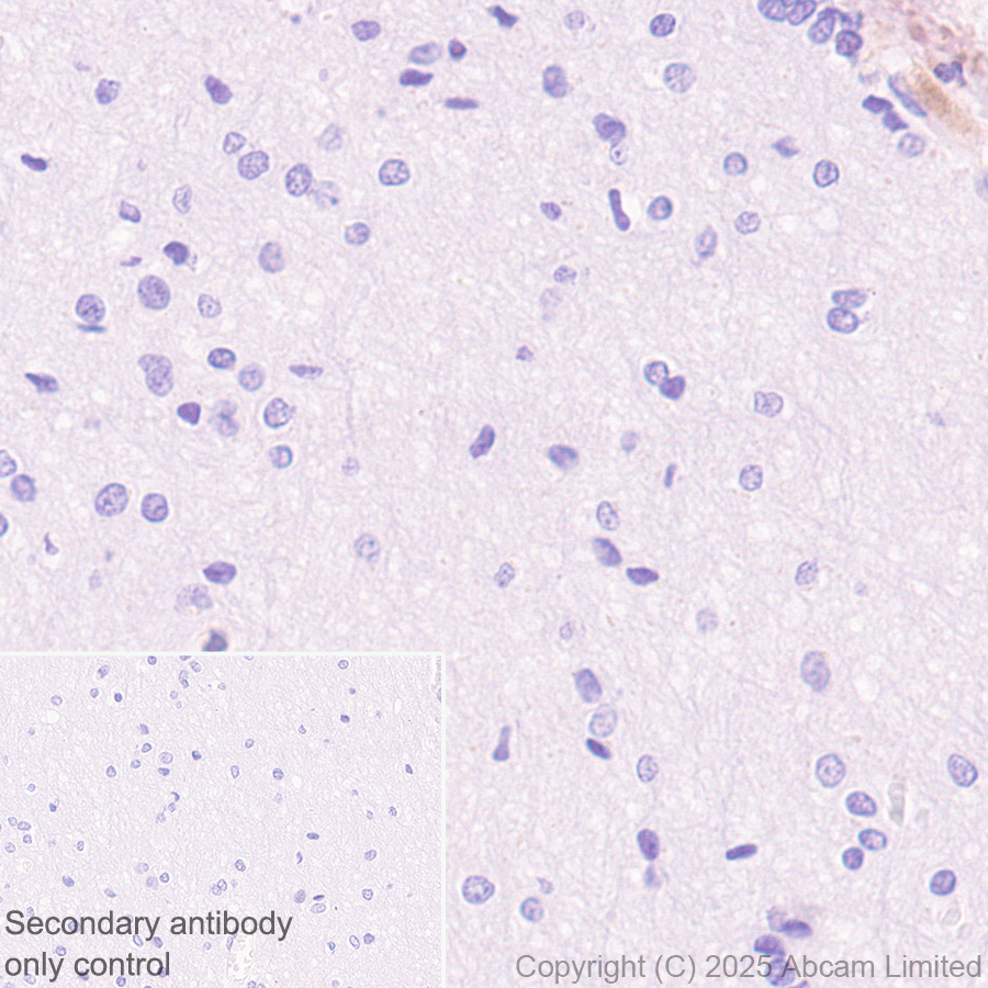 Immunohistochemistry (Formalin/PFA-fixed paraffin-embedded sections) - Anti-C3 antibody [RM1270] (AB324288), expandable thumbnail