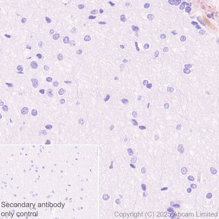 Immunohistochemistry (Formalin/PFA-fixed paraffin-embedded sections) - Anti-C3 antibody [RM1270] (AB324288)