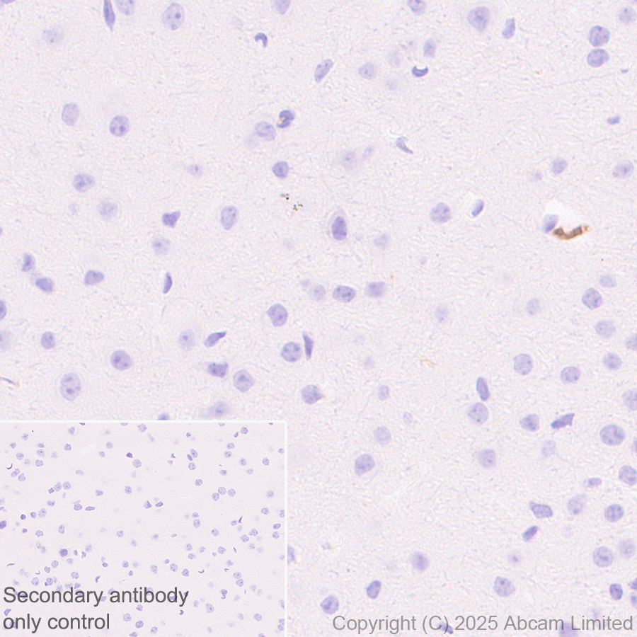 Immunohistochemistry (Formalin/PFA-fixed paraffin-embedded sections) - Anti-C3 antibody [RM1270] (AB324288), expandable thumbnail