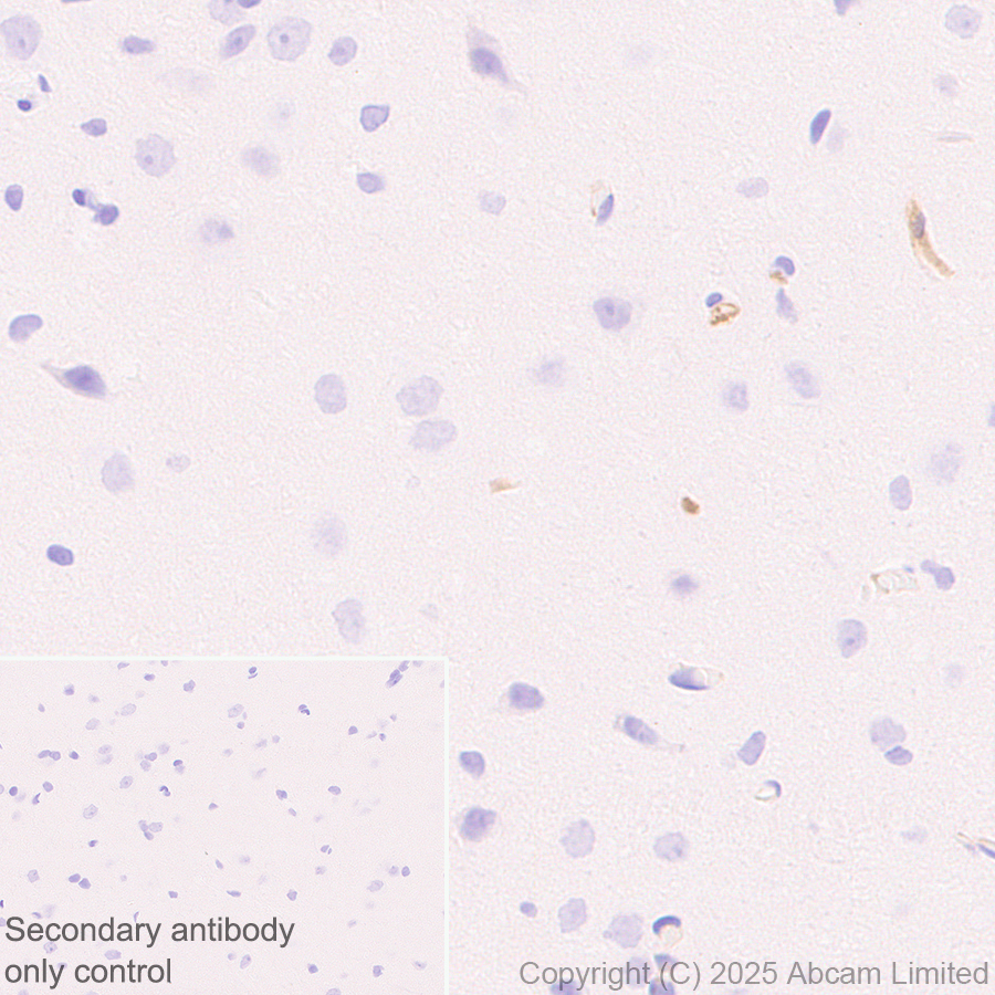 Immunohistochemistry (Formalin/PFA-fixed paraffin-embedded sections) - Anti-C3 antibody [RM1270] (ab324288), expandable thumbnail