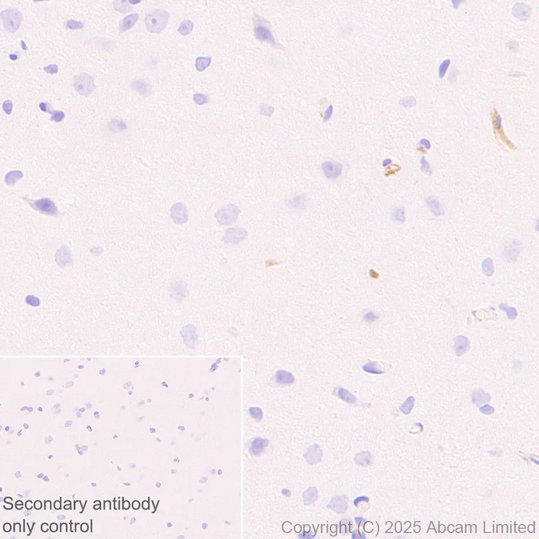 Immunohistochemistry (Formalin/PFA-fixed paraffin-embedded sections) - Anti-C3 antibody [RM1270] (AB324288)