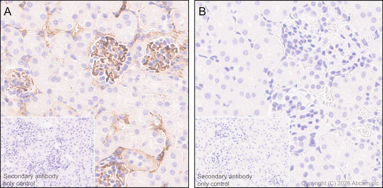 Immunohistochemistry (Formalin/PFA-fixed paraffin-embedded sections) - Anti-C3 antibody [RM1270] (AB324288)
