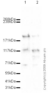 Western blot - Anti-C3 / C3a antibody [2898] (AB11874)