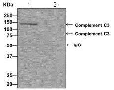 Immunoprecipitation - Anti-C3 / C3a antibody [EPR2987(2)(ABC)(B)] (AB171080)