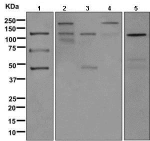 Western blot - Anti-C3 / C3a antibody [EPR2987(2)(ABC)(B)] (AB171080)