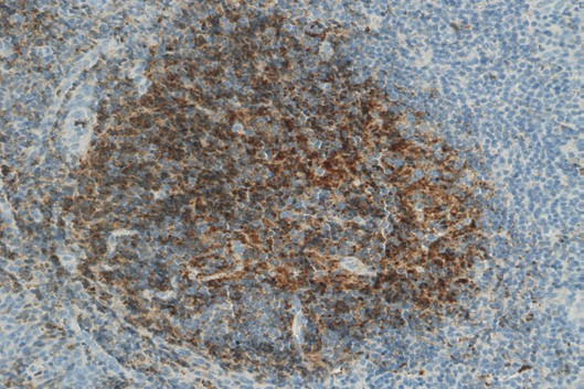Immunohistochemistry (Formalin/PFA-fixed paraffin-embedded sections) - Anti-C3 / C3b antibody [755] (AB11871), expandable thumbnail