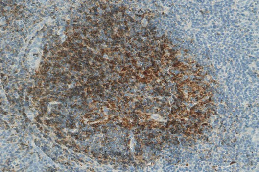 Immunohistochemistry (Formalin/PFA-fixed paraffin-embedded sections) - Anti-C3 / C3b antibody [755] (AB11871)