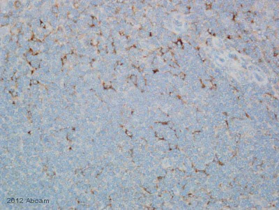 Immunohistochemistry (Formalin/PFA-fixed paraffin-embedded sections) - Anti-C3 / C3b antibody [755] (AB11871)