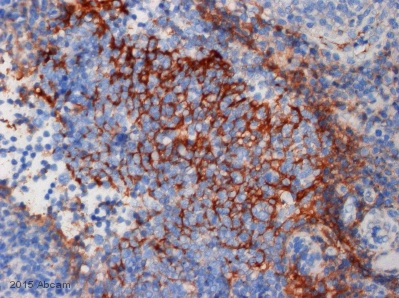 Immunohistochemistry (Formalin/PFA-fixed paraffin-embedded sections) - Anti-C3 / C3b antibody [755] (AB11871), expandable thumbnail