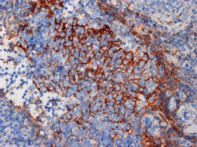 Immunohistochemistry (Formalin/PFA-fixed paraffin-embedded sections) - Anti-C3 / C3b antibody [755] (AB11871)