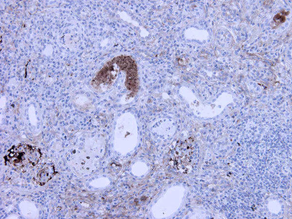 Immunohistochemistry (Formalin/PFA-fixed paraffin-embedded sections) - Anti-C3a / C3a des Arg antibody [K13/16] (AB36385)