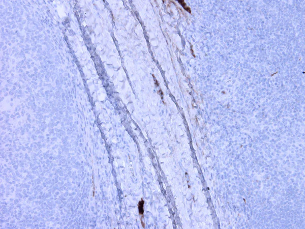 Immunohistochemistry (Formalin/PFA-fixed paraffin-embedded sections) - Anti-C3a / C3a des Arg antibody [K13/16] (AB36385)