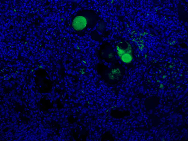 Immunohistochemistry (Formalin/PFA-fixed paraffin-embedded sections) - Anti-C3a / C3a des Arg antibody [K13/16] (AB36385)