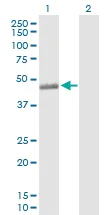 Western blot - Anti-C3a R antibody (AB103629)