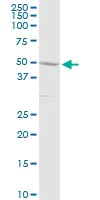 Western blot - Anti-C3a R antibody (AB103629)