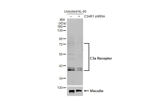 Western blot - Anti-C3a R antibody (AB126250)