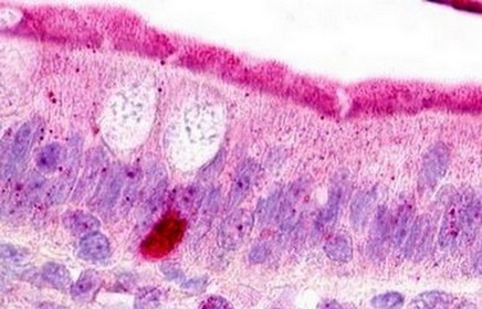 Immunohistochemistry (Formalin/PFA-fixed paraffin-embedded sections) - Anti-C3a R antibody (AB140788)