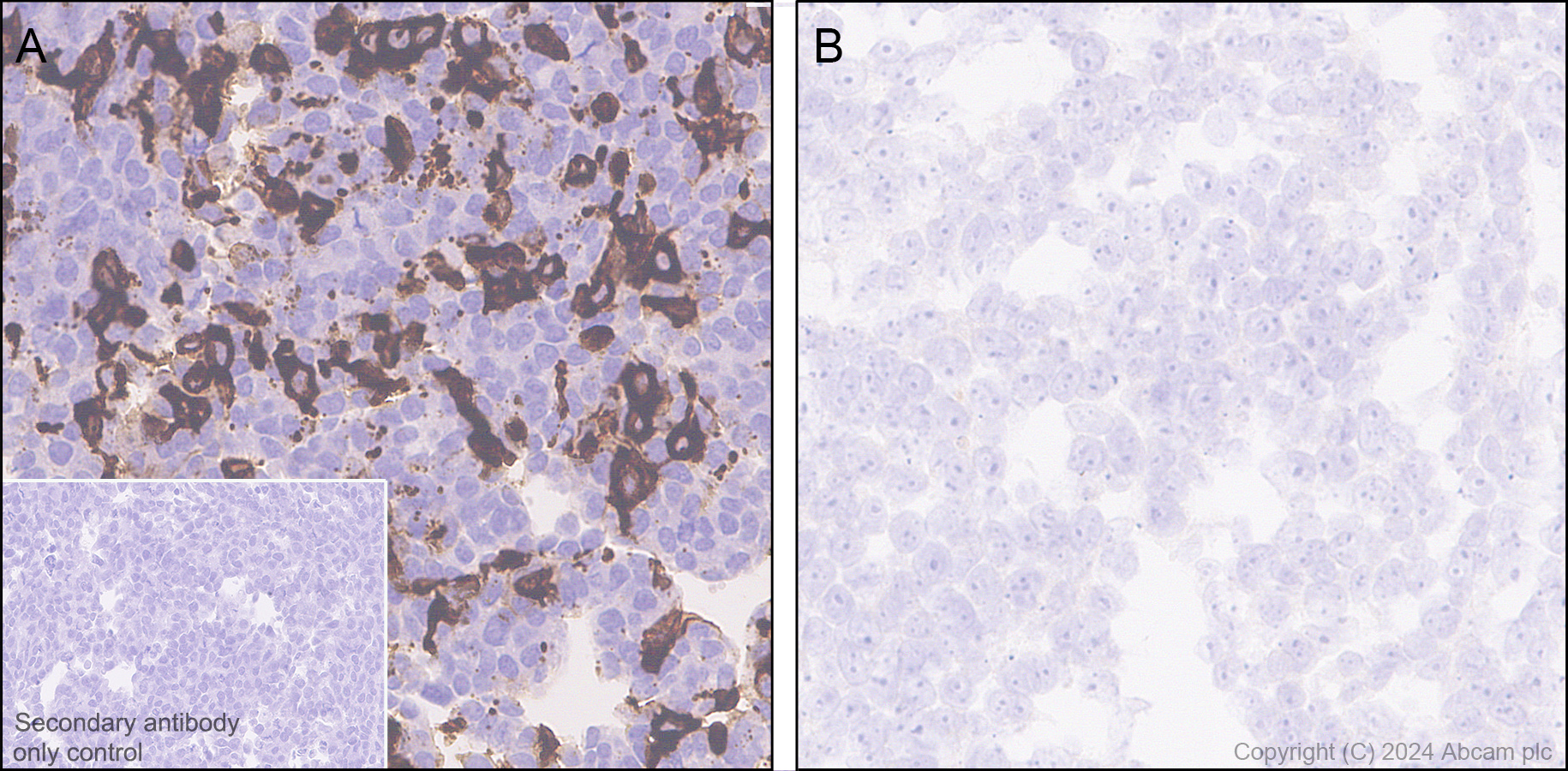 Immunohistochemistry (Formalin/PFA-fixed paraffin-embedded sections) - Anti-C3a R antibody [EPR28765-1] (AB317321), expandable thumbnail