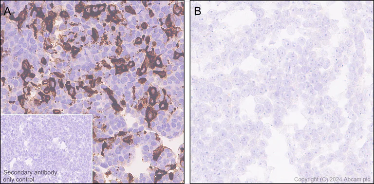 Immunohistochemistry (Formalin/PFA-fixed paraffin-embedded sections) - Anti-C3a R antibody [EPR28765-1] (AB317321)