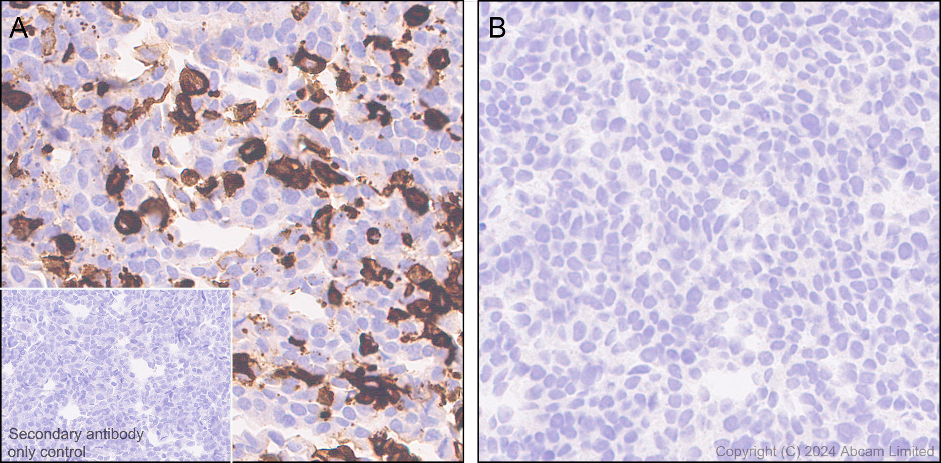 Immunohistochemistry (Formalin/PFA-fixed paraffin-embedded sections) - Anti-C3a R antibody [hC3aRZ8] - BSA and Azide free (AB317633)