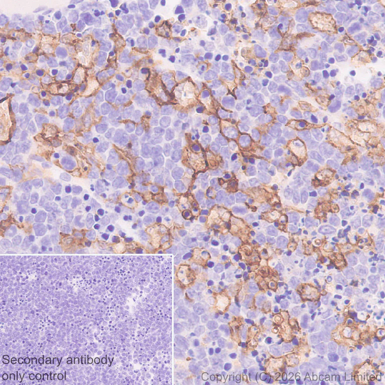Immunohistochemistry (Formalin/PFA-fixed paraffin-embedded sections) - Anti-C3AR1 antibody [EPR31126-546] (AB327652)