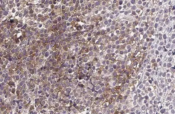 Immunohistochemistry (Formalin/PFA-fixed paraffin-embedded sections) - Anti-C3AR1 antibody [HL2831] - BSA and Azide free (AB325839)